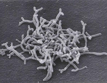 Пищевые добавки пробиотики навалом Bifidobacterium Bifidum Powder