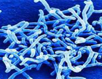 Массовая цена Пищевая добавка Пробиотики Bifidobacterium Longum